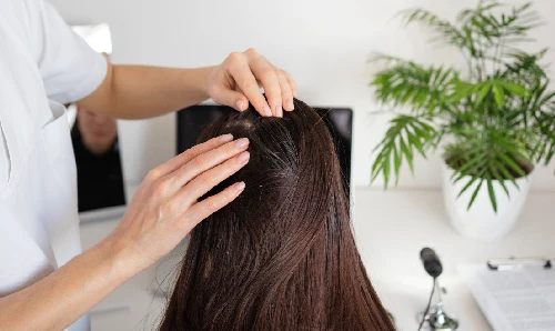 Hair Fall Control Programs Hair Fall Control Programs